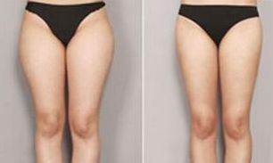 合肥祛痘效果最好的醫(yī)療美容機(jī)構(gòu)有哪些？