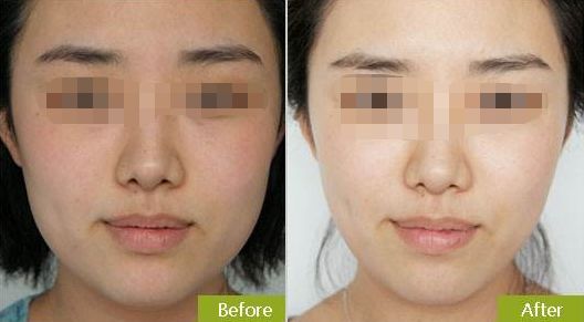 蘇州哪家整形外科醫(yī)院好？快速了解蘇州市頂級整形外科醫(yī)院推薦