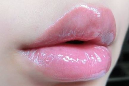 西寧哪家醫(yī)院的雙眼皮效果好？