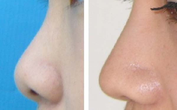 2023中山膠原蛋白注射豐唇正規(guī)醫(yī)生上榜TOP10強(qiáng)(王斌、羅海軍、劉志靜經(jīng)驗(yàn)豐富！)