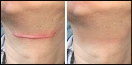 南京哪家私密醫(yī)院做得最好？來(lái)一探究竟！