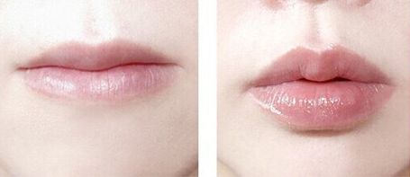 佛山做鼻子手術(shù)哪家醫(yī)院靠譜？