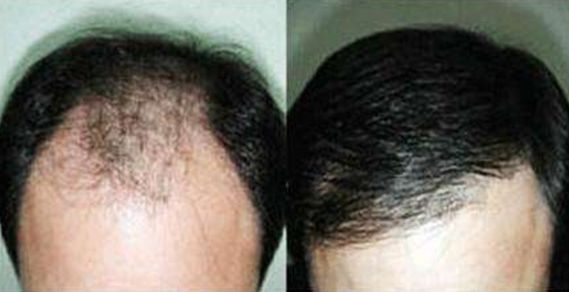 大連去狐臭哪家醫(yī)院效果好，專家推薦的醫(yī)院有哪些？