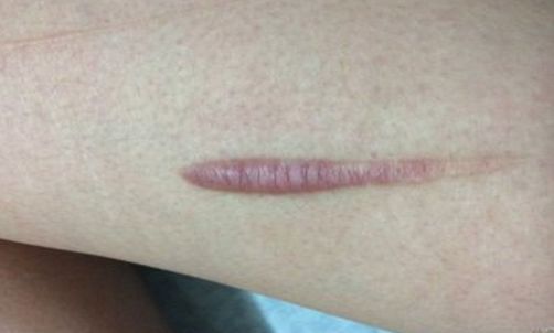 【2023年揚(yáng)州雙眼皮正規(guī)醫(yī)院排行榜公布！最靠譜的哪家好？】