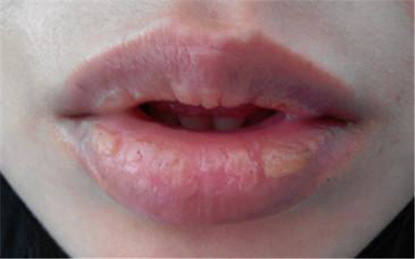 2023成都抗衰除皺正規(guī)醫(yī)生評價前10名(萬端能、金可、趙敬國技術(shù)強口碑UP)