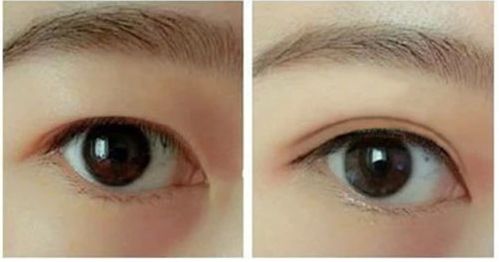 南昌做隆胸手術(shù)哪家好？選南昌最受歡迎的隆胸手術(shù)醫(yī)院有哪些