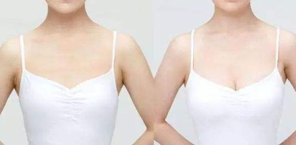 威海假體豐胸醫(yī)院哪家好？從專家口碑、手術(shù)效果看威海頂級醫(yī)院推薦！