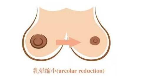 長沙激光美容醫(yī)院哪家好？探尋長沙地區(qū)激光美容行業(yè)領(lǐng)軍者