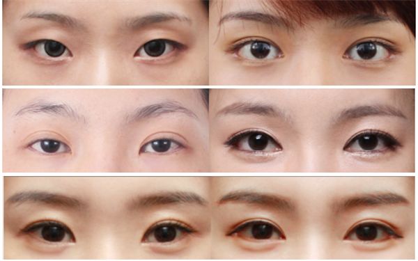 福州埋線減肥醫(yī)院哪家好？了解福州埋線減肥醫(yī)院的專業(yè)優(yōu)勢(shì)和患者評(píng)價(jià)