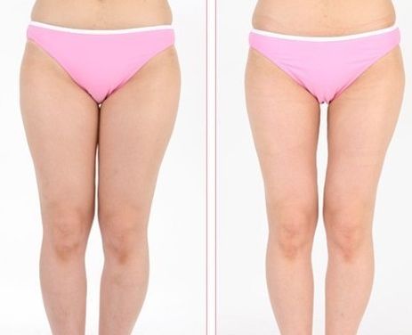 株洲祛痘哪家醫(yī)院靠譜？探尋株洲專業(yè)祛痘醫(yī)療機(jī)構(gòu)！