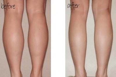 2023武漢隱耳矯正術(shù)權(quán)威醫(yī)生排行榜前10名(嚴(yán)飛、李蓮珍、潘虹讓整形更有保障)