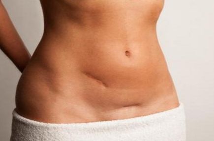 常州哪家醫(yī)院的激光祛痘療效好？