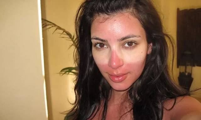 2023黑龍江注射去抬頭紋正規(guī)專家口碑前幾(郭福林、宮立民、朱勝軍實力口碑)