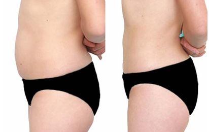 武漢哪家整形醫(yī)院的凸嘴技術好，值得信賴？