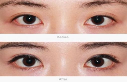 柳州哪家醫(yī)院做疤痕切除好？-獨(dú)家分享柳州疤痕切除醫(yī)院排行榜