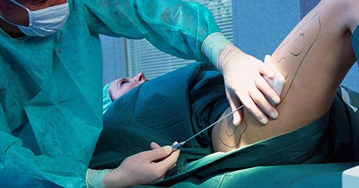 廣州美容整形醫(yī)院哪家好？推薦2023年評(píng)選的廣州頂尖美容整形醫(yī)院