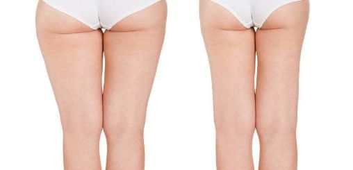 2023年西寧最受推薦的醫(yī)院紅血絲治療服務(wù)是哪家？