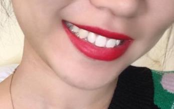 2023青島面部填充醫(yī)生前10(常書(shū)樓、白華寶、尹孝憲細(xì)數(shù)各家口碑)