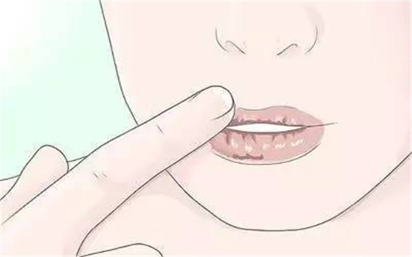 2023南寧光子嫩膚治療黑頭醫(yī)生前十位排行(高靜、周智華、韋文峰閉眼選擇不踩雷~)