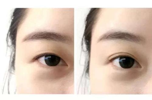 2023青島胸部假體取出手術(shù)排名榜前十醫(yī)生(郭華、趙宏武、張思浩技術(shù)實(shí)力好！放心選~)