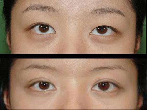 2023武漢冷凍法酒糟鼻治療top10的醫(yī)生(陳佳旭、馬超群、王介聰從實力看不輸公辦)