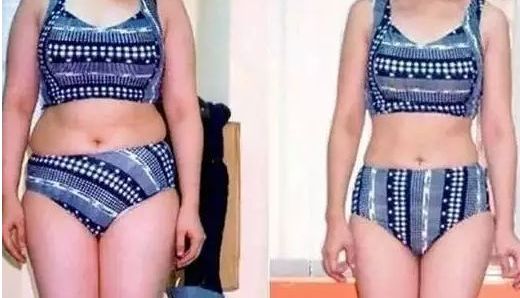 上海哪家醫(yī)院有最有效的黑眼圈去除治療？