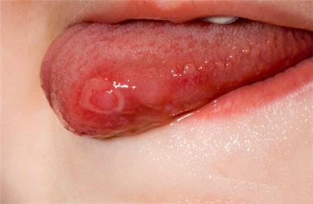 2023信陽精雕瘦腰部專家排行前十位(正冬學(xué)、李孝輝、周平價(jià)格實(shí)惠公道)