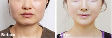 南昌熱瑪吉哪家醫(yī)院做得好？專業(yè)推薦南昌市xx醫(yī)院