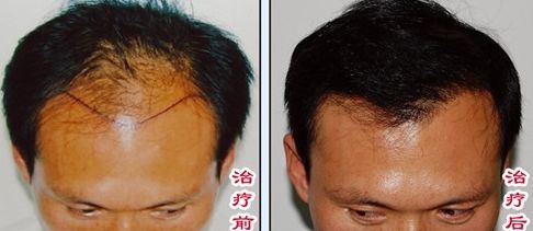 榆林醫(yī)專附屬醫(yī)院醫(yī)學整形美容中心怎么樣？榆林醫(yī)專附屬醫(yī)院醫(yī)學整形美容中心簡介|醫(yī)生團隊|口碑評價！