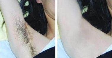 成都整下巴哪家醫(yī)院好，專家助你實現(xiàn)完美下巴線條