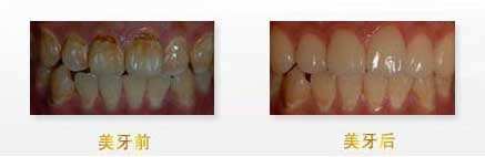 揭秘：武漢眼科醫(yī)生，他們的技術(shù)無人能敵！