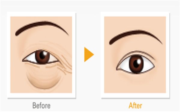 哈爾濱隆胸修復(fù)醫(yī)院排名及口碑對(duì)比，哪家專業(yè)又靠譜？