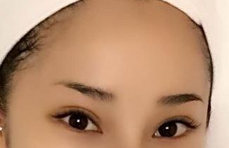 合肥哪家醫(yī)院臉部激光治療效果好，值得推薦？