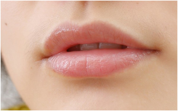 2023鹽城眉間紋打玻尿酸前十強(qiáng)醫(yī)生排名榜(葛乃航、杜康、于海洲人氣口碑實(shí)力三合一推薦)