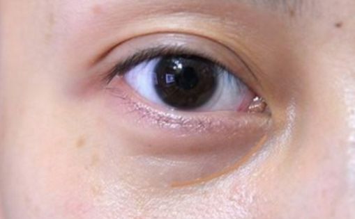 邯鄲哪家醫(yī)院做私密整形好？解析當(dāng)代女性美容訴求