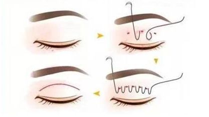 南寧夢想醫(yī)療美容門診部的項目有哪些值得了解的特色？