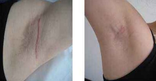 深圳激光美容醫(yī)院排名及口碑哪家好？