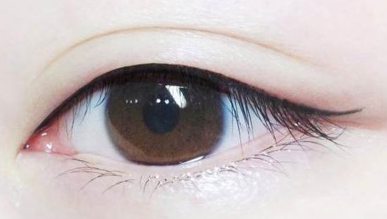 【長(zhǎng)治哪家醫(yī)院祛痣效果好？專家推薦讓你放心選擇】