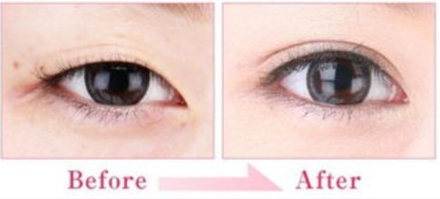 石家莊碧蓮盛-開啟新植發(fā)時(shí)代，選擇明星級(jí)植發(fā)醫(yī)生