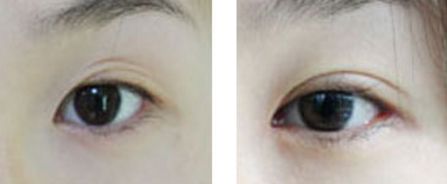 汕頭市整形醫(yī)院有哪些？哪家整形醫(yī)院在汕頭市口碑好？