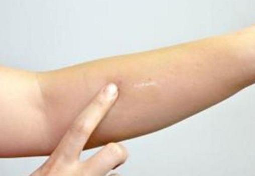 蘇州吸脂瘦身醫(yī)院哪家好？選個(gè)最適合你的專業(yè)醫(yī)療機(jī)構(gòu)