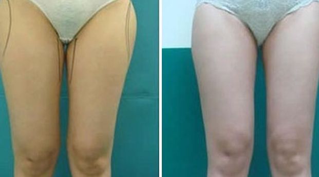 揭陽激光美容醫(yī)院哪家好？選擇揭陽最佳激光美容醫(yī)院的7個(gè)關(guān)鍵要素！