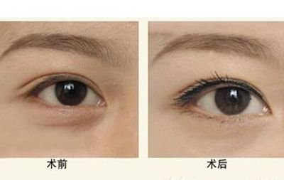 寧波隆鼻Top5醫(yī)生：技術(shù)精湛，聲譽(yù)卓越，口碑贊不絕口！