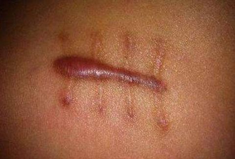 貴陽胎記治療醫(yī)院的名氣有哪些？