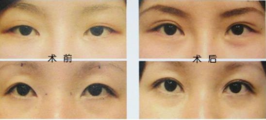 揭秘佛山哪家整形醫(yī)院吸脂好？導(dǎo)醫(yī)全解析、患者口碑高，信賴度高！