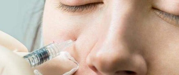 西安哪家醫(yī)院激光去斑效果最好？