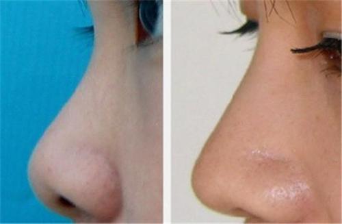 2023柳州背部激光溶脂排行榜10強(qiáng)醫(yī)生(龍昕、亓發(fā)芝、湯維華讓你變美更放心，更安全！)