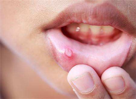 2023杭州注射膠原蛋白隆鼻排名前幾的醫(yī)生(潘虹、吳晶琰、熊麗優(yōu)質(zhì)醫(yī)生任你選擇)