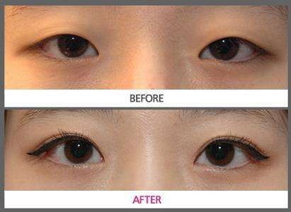 2023臺(tái)州吸脂溶脂權(quán)威醫(yī)生口碑前十名(陳巍、崔義澤、成浩口碑優(yōu)異！速看！)