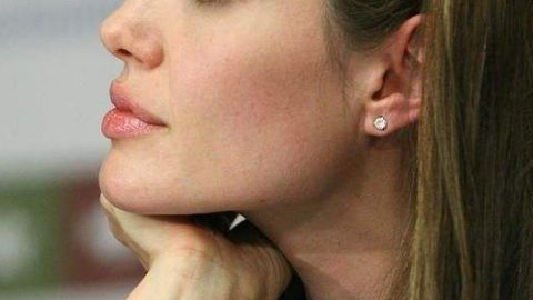 深圳藝星熱瑪吉的效果和醫(yī)生如何？檢索資格和排版!